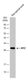 Anti-MPZ antibody used in Western Blot (WB). GTX134079
